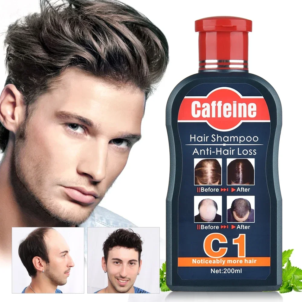 Hair Care Korean Products - ผู้ชายแชมพูสําหรับ Hair Growth พืชธรรมชาติคาเฟอีน Anti Hair