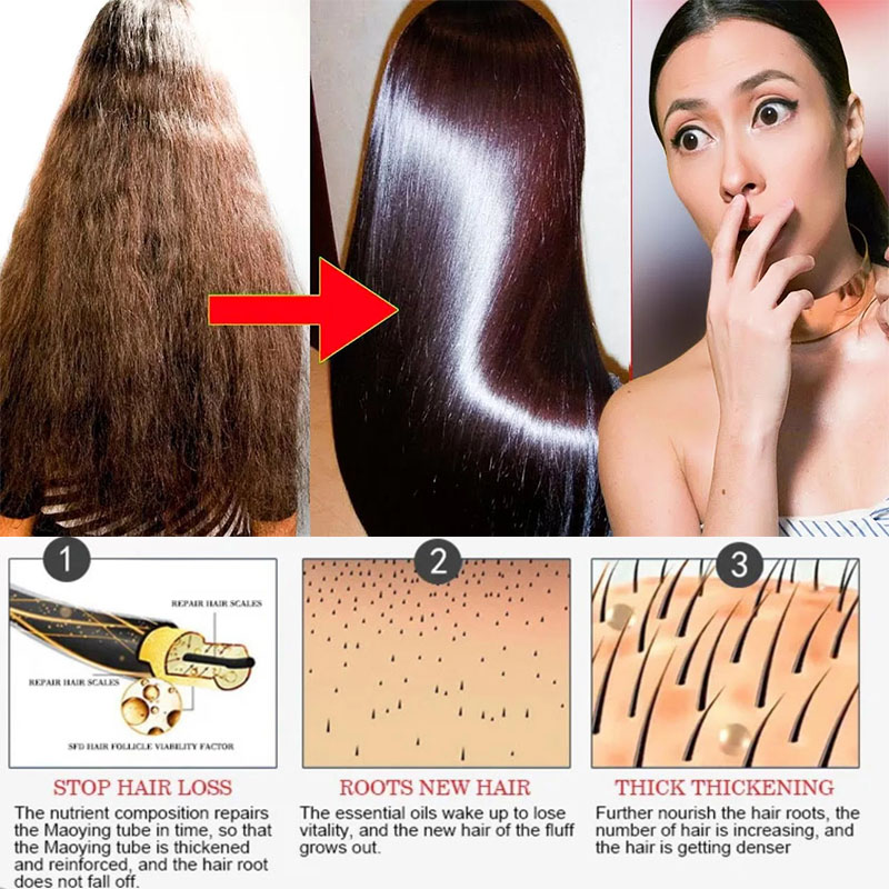 มาส์กบำรุงผมเคราตินมหัศจรรย์ 5 - Hair Care Normal บทวิจารณ์และราคา