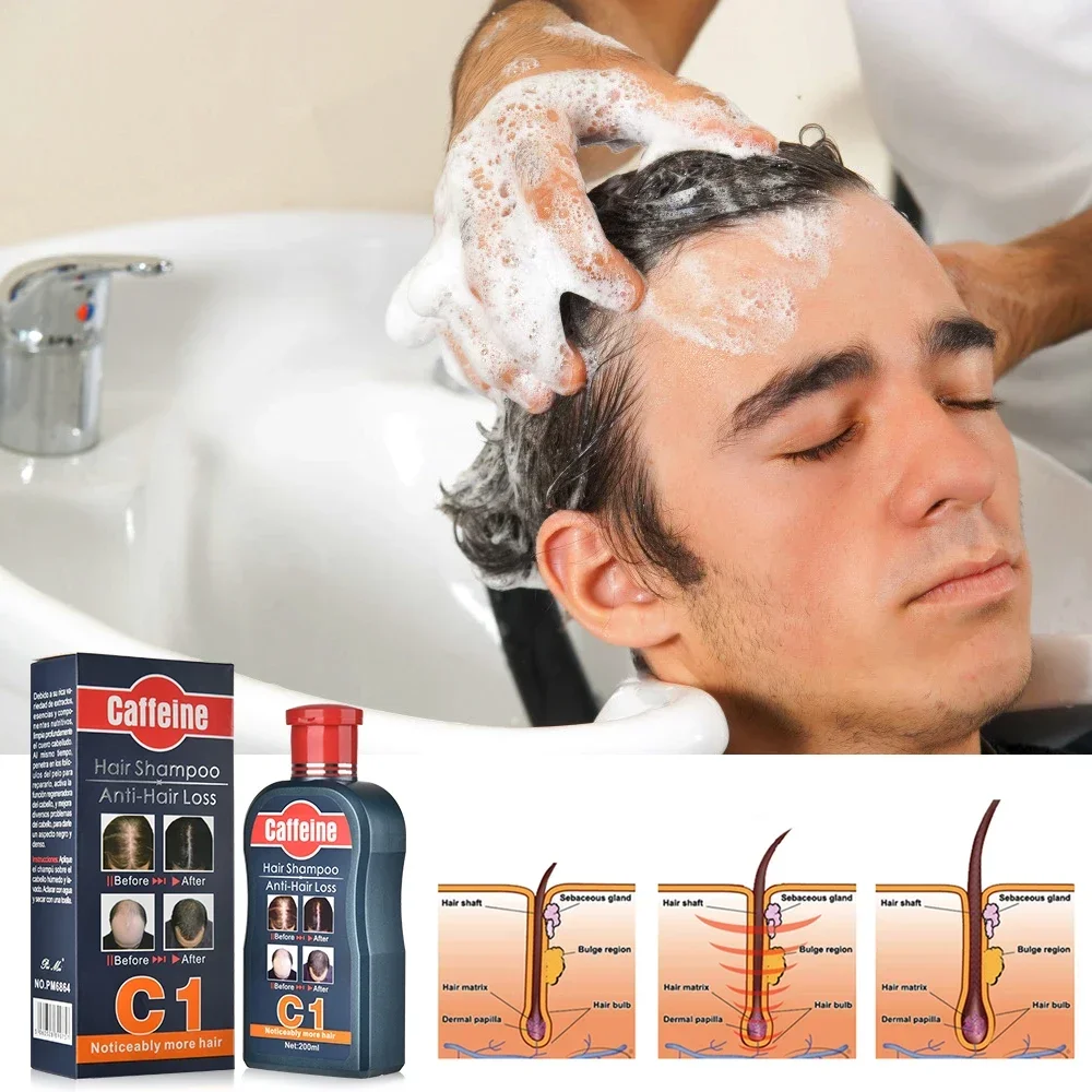 ผู้ชายแชมพูสําหรับ Hair Growth - Hair Care Korean Products บทวิจารณ์และราคา