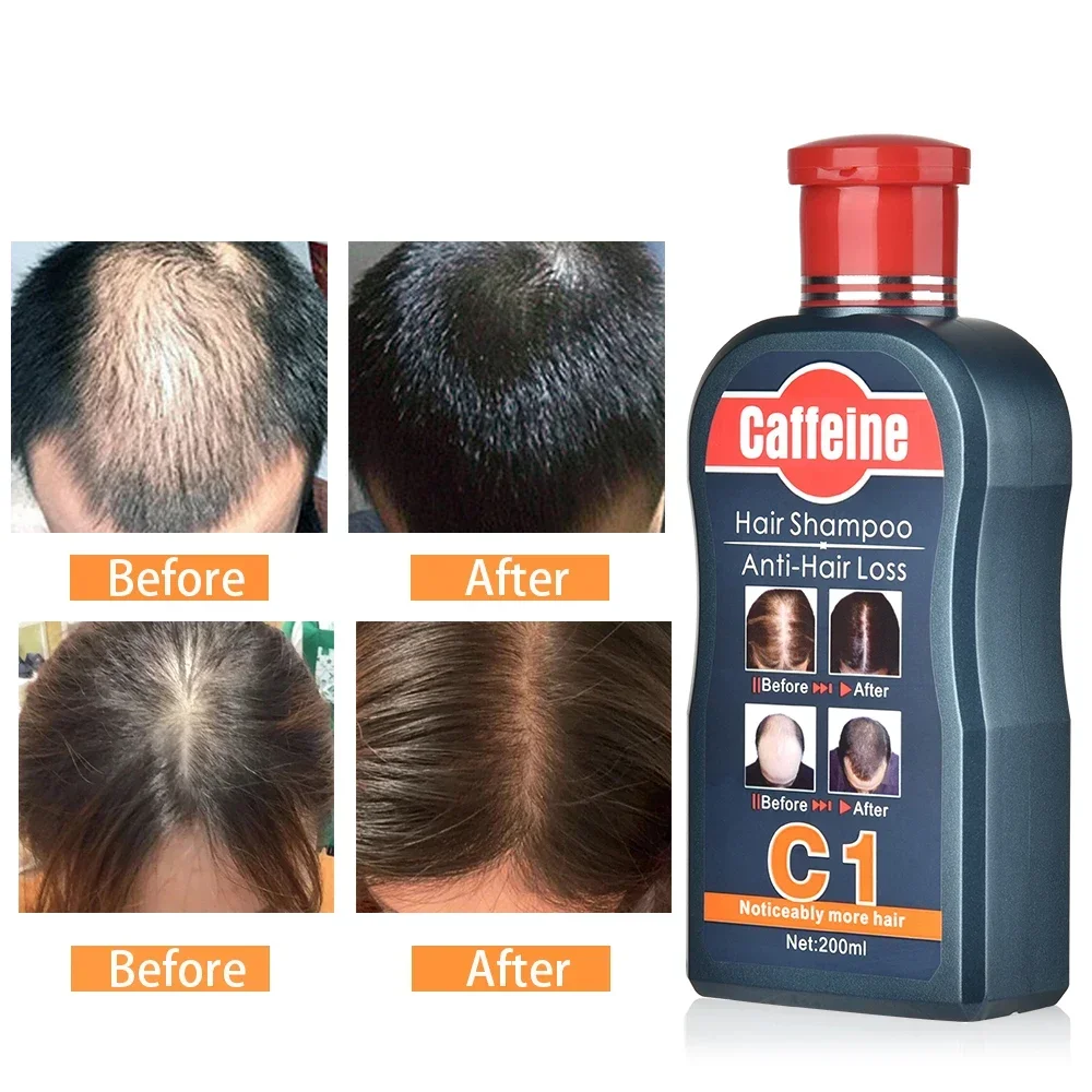 ผู้ชายแชมพูสําหรับ Hair Growth - Hair Care Korean Products บทวิจารณ์และราคา